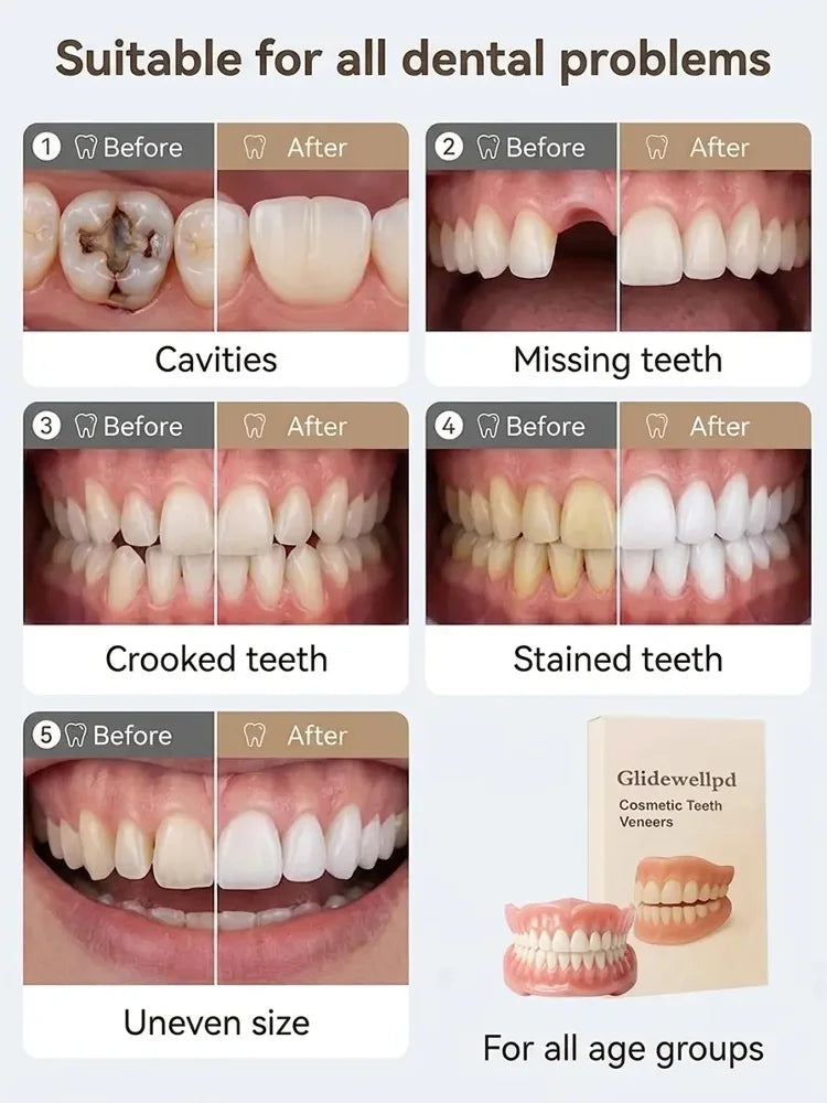 🔥 Custom-Fit Instant Smile Dentures – Natural Look & Comfort Fit | 50% OFF Today
