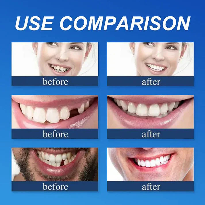 🏆2026 Bestselling🔥Product Fit for a FreshSmile, Say Goodbye to Wearing Discomfort!🌎