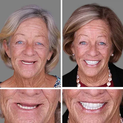 🏆2026 Bestselling🔥Product Fit for a FreshSmile, Say Goodbye to Wearing Discomfort!🌎