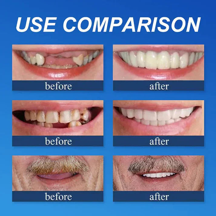 🏆2026 Bestselling🔥Product Fit for a FreshSmile, Say Goodbye to Wearing Discomfort!🌎